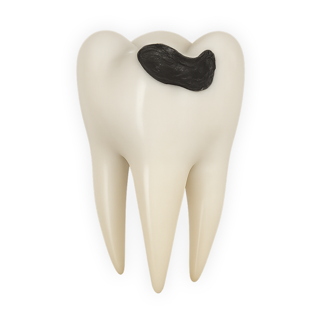 Tooth with visible cavity, illustrating the hidden consequences of delaying dental care